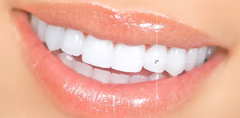 Teeth Jewellery